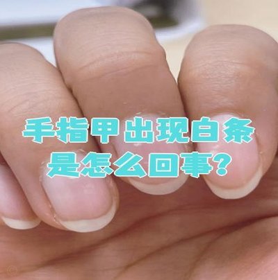 白条怎么回事